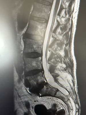 Visualización óptima