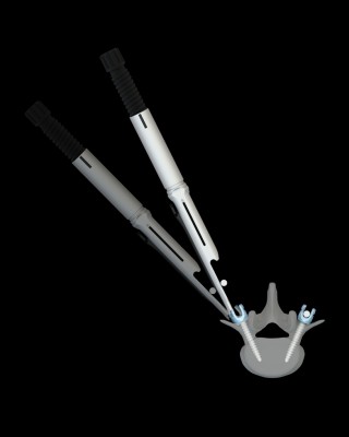 Lateral translation with unilateral reducer