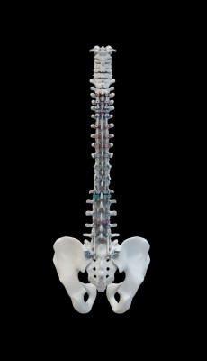 PERLA® TL Montage final