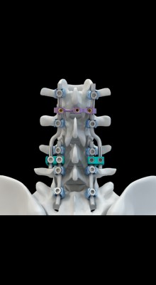 Gama completa de barras y conectores