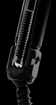 Réduction intégrée de 20 mm