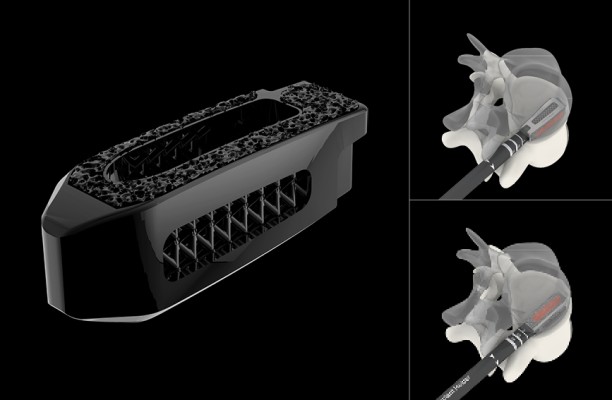 Option d’insertion/rotation disponible