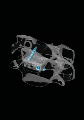 SCARLET® AC-Ti - Anatomical view
