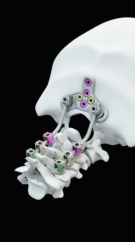 PERLA® - Spineart