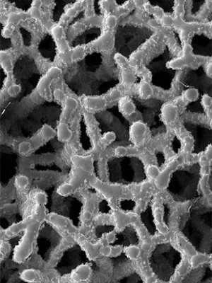 Structure poreuse Ti-LIFE