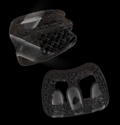 Integrated screw channel